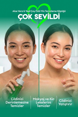 Doğal Yüz Temizleme Köpüğü Niacinamide Aloe Vera Özlü 150 Ml
