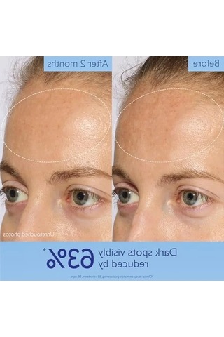 30 Ml Işıltı Verici Leke Karşıtı Serum
