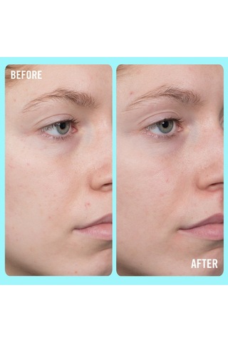 First Aid Beauty 10% Vitamin C Brightening Serum - Aydınlatıcı Serum 50 Ml