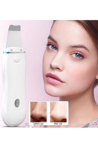 Ultrasonik Cilt Scrubber Akne Ve Siyah Nokta Temizleyici Yüz Peeling Spatula Gözenek Arındırma Aracı 7454