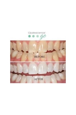 Opalescence Ultradent Go Hazır Kalıp Nane Diş Beyazlatma 8'li