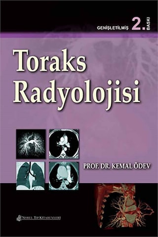 Toraks Radyolojisi- Nobel Tıp Kitabevleri Toraks Radyolojisi- Nobel Tıp Kitabevleri
