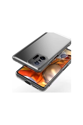 Adige Xiaomi Mi 11t 5g Kılıf Kamera Korumalı Süper Silikon