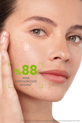 Bioderma Sebium Yağlı ve Akneli Ciltler İçin Sivilce Karşıtı Serum 30 ML