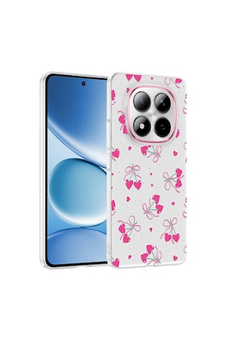 Teleplus Xiaomi Redmi Note 15 Pro 4g Kılıf Klipx Serisi Mat Desenli Tpu Kapak