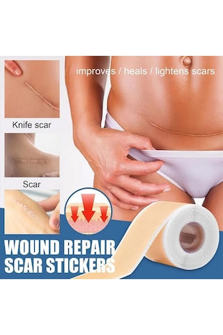 10-50 Cm Silikon Yara Izleri Yama Yara Bandı Sivilce Yanık Yara Izi Tedavisi Kapak Kulak Düzelticiler Verimli Onarım Hasarlı Cilt Levha