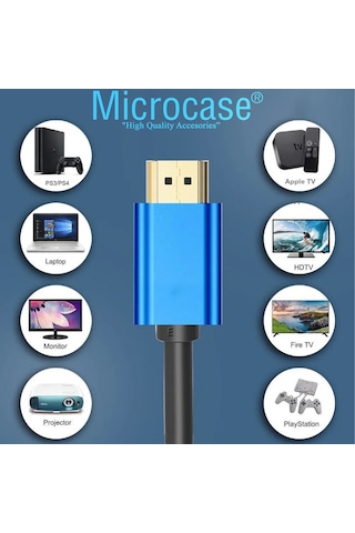 Microcase Yüksek Hızlı 4k Ultra Hd Hdmı Kablo 3 Metre - Al3772