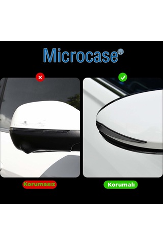 Microcase Universal Esnek Ayna Ve Kapı Kenar Çizilme Önleyici Koruyucu Seti 4lü Al5360 Siyah