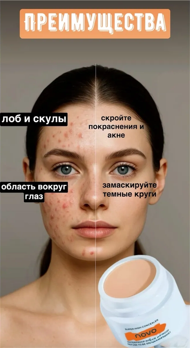 Nova 02 Yuz Kapatıcı 464786556