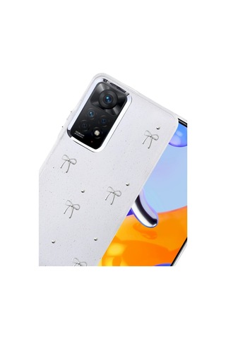 Dilaratrendhouse Redmi Note 11 Pro Fiyonk Desenli Kapak - Desen 5 Dlra