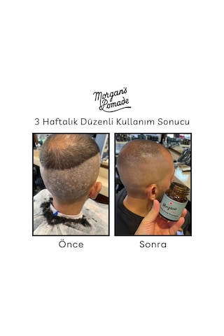 Morgan's Pomade Cooling Scalp Treatment - Egzama Kepek Karşıtı Baş Derisi Bakım Tedavisi 100 G