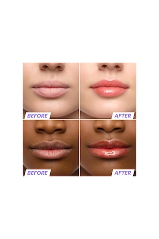 Wonderskin Lip Rehab Nemlendirici Ve Onarıcı Renkli Dudak Serumu Yağı Flirt 3.57ml