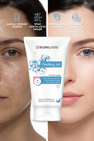 Arındırıcı Ve Siyah Nokta Temizleyici Peeling Jel 150 Ml