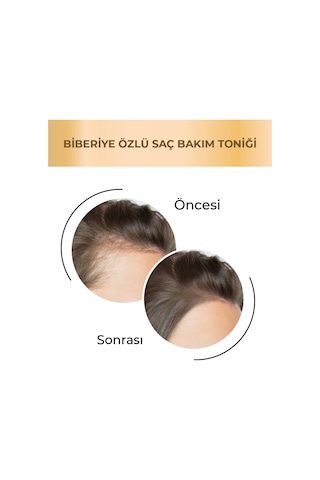 Agarta Saf Biberiye Suyu Saç Toniği Dökülme Karşıtı Ve Saç Uzamasını Destekleyici Tonik 125 ML