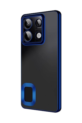 Noktaks - Xiaomi Uyumlu Xiaomi Redmi Note 13 Pro 5g - Kılıf Kamera Korumalı Tatlı Sert Omega Kapak - Rose Gold