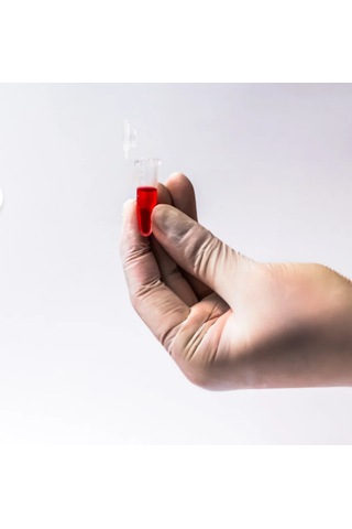 Eppendorf Tüp 1.5 Ml - 10.000 Adet