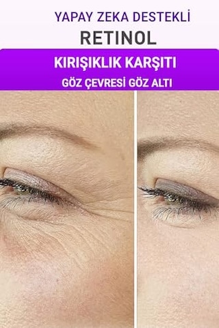 Tr Retinol + Kolajen + C Vitamini Serum 3 Lü Set Kırışıklık Alın Çizgisi Göz Çevresi