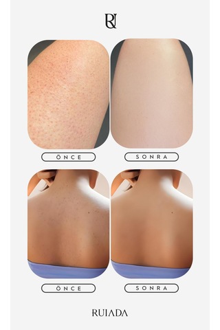 80 Factor Ekru Banyo Duş Kesesi Peeling Eldiveni %100 Floş Ipek Premium Kadın Ve Erkekler Için