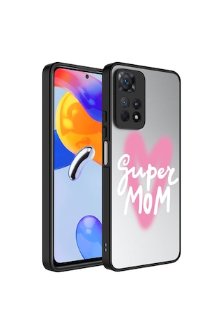 Zore Redmi Note 11 Pro 5g Kılıf Aynalı Desenli Kamera Korumalı Parlak Msra Mirror Kapak - Süper Anne Süper Anne