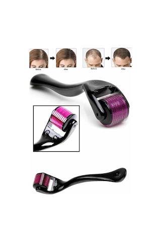 Derma Roller Titanyum Uçlu 540 İğneli 1 Mm Saç Sakal Çıkarma Ve Cilt Bakım Masaj Aleti