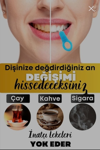 Upeka Diş Beyazlatma Kiti