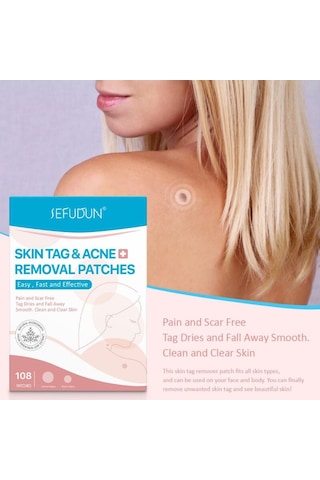 108 Adet Cilt Etiketi Akne Kaldırma Yamalar Ağrısız Pürüzsüz Temiz Temizle Cilt Hızlı Sökücü Sivilce Siğil Ana Yama Tedavisi Korur