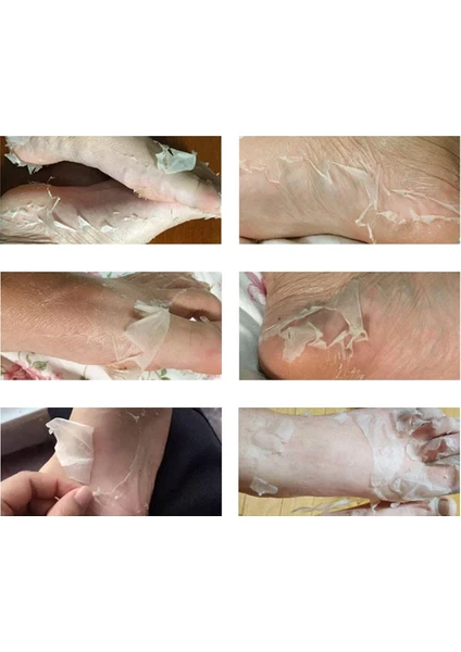 Nasır ve Ölü Deri Temizleyici Ayak Peeling Maskesi