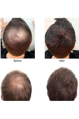 Sevich 25 Gr Siyah Saç Fiberi Keratin Saç Tozu (413145482)