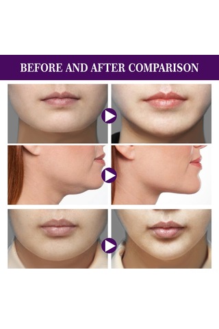 Youtek Eelhoe 60 Adet V Şekilli Su Geçirmez Yüz Germe Bandı - Cilt Dostu Esnek Yapışkan Bant