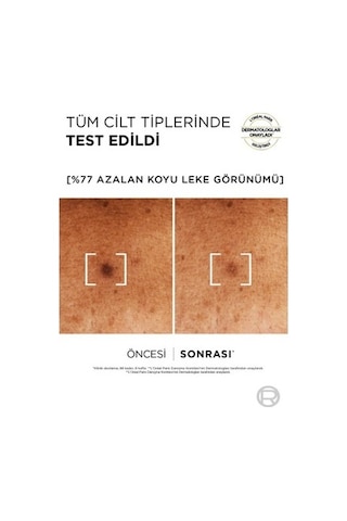 L'oréal Paris Koyu Leke Karşıtı Serum %10 Niasinamid 30 Ml Normal Ciltler İçin