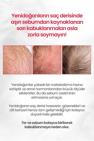 Bebeklere¥idoğanlara Özel Göz Yakmayan Konak&sebum Karşıtı Şampuan Atopalm Newborn Scalp Shampoo