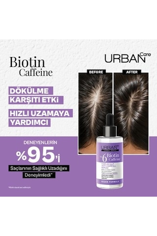 Dökülme Karşıtı Saç Bakım Şampuanı - 350 Ml Biotin Ve Kafein