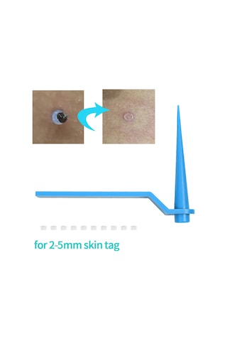 Hangfox 50 Adet Mavi Cilt Etiket Kaldırıcı Aleti - 4-8mm Büyük Boy Lastik Bantlı Bakım Aracı