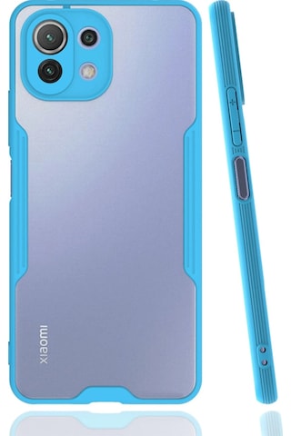 Uryport Xiaomi Mi 11 Lite Kılıf Platin Silikon - Mavi