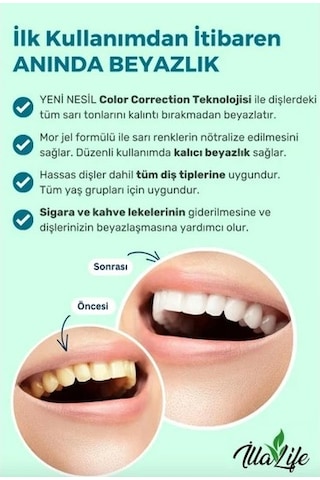 İlla Life Whitening Expert Hızlı Etkili Diş Beyazlatıcı Jel 50 ML