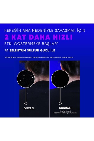 Lexroo Clinical Strength Advanced Oil Control Yağ Dengeleyici Şampuan 400 Ml Yağlı