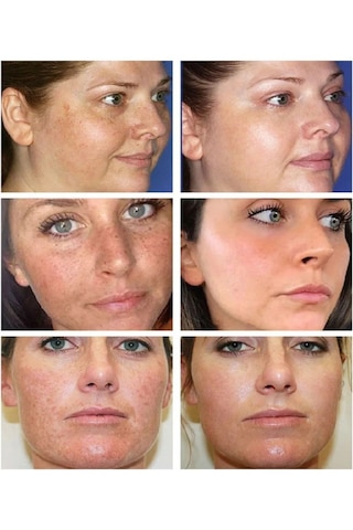 Mazhar Beyazlatıcı Kanza Kremi Sabun ve Serum Seti 3'lü Set 1 Kutu