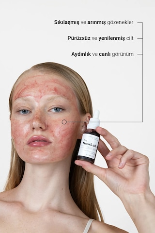 The NewLab Canlandırıcı & Cilt Tonu Eşitleyici Kırmızı Peeling Serum 30 Ml (Aha 10% Bha 2%)