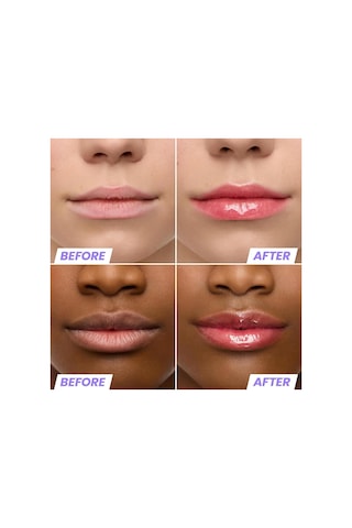 Wonderskin Lip Rehab Nemlendirici Ve Onarıcı Renkli Dudak Serumu Yağı Amour 3.57ml