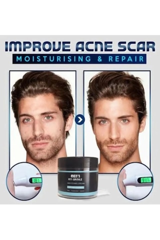 Süper Men's Anti-wrinkle Cream Erkek Yaşlanma Kırışıklık Karşıtı Yüz Bakım Kremi 100 Ml