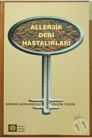 Alerjik Deri Hastalıkları N11.298 Alerjik Deri Hastalıkları N11.298