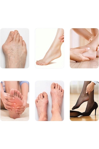 Akestoria Med Ayarlanabilir Cırtlı Baş Parmak Kemik Jel Düzeltici Fc-004 Standart