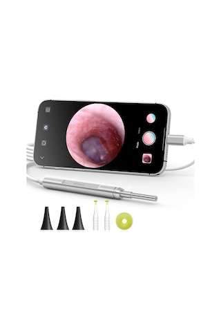Anykit Dijital Otoskop, Ultra Net Görüşlü Kulak Kamerası - İpad/iphone/android
