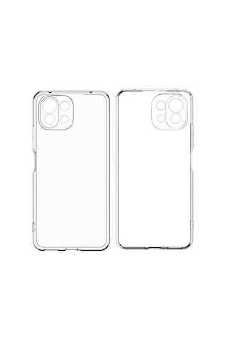 Adige Xiaomi Mi 11 Lite Kılıf Kamera Korumalı Süper Silikon