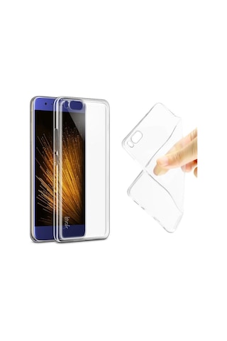 Xiaomi Mi6 Kilif Ultra Lüx Tam Korumali Esnek Silikon Kilif 405369658