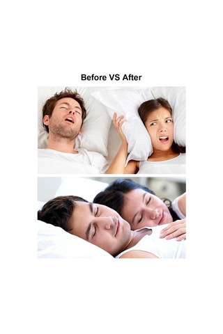 Qingmipy "görünmez Burun Genişletici - Horlamayı Önler, Rahat Nefes Sağlar 3 Adet M Beden "