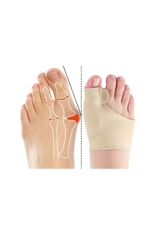 Akestoria Med Baş Parmak Kemik Düzeltici Ve Koruyucu Makarlı Unisex Fc-038 L