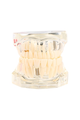 Samdoo Diş Sağlığı Eğitim Modeli: Şeffaf, Ayrılabilir Mandibula Ve Maksila - Diş Yapısı Ve İmplantasyon Öğretimi Çok Renkli