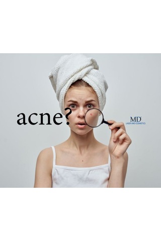 Dermasolin Acne Care Deep Cleansing 100 ML