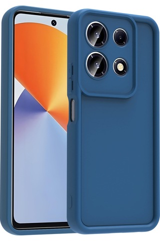 İnfinix Note 30 4g Kılıf Esnek Ve Yumuşak Dokulu Telefonu Çizmeyen Soft Silikon Kapak Royal Case/ananas Koyu Yeşil